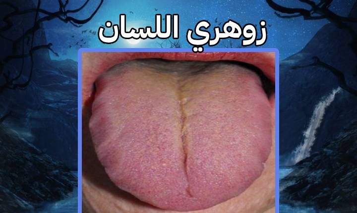 زوهري اللسان