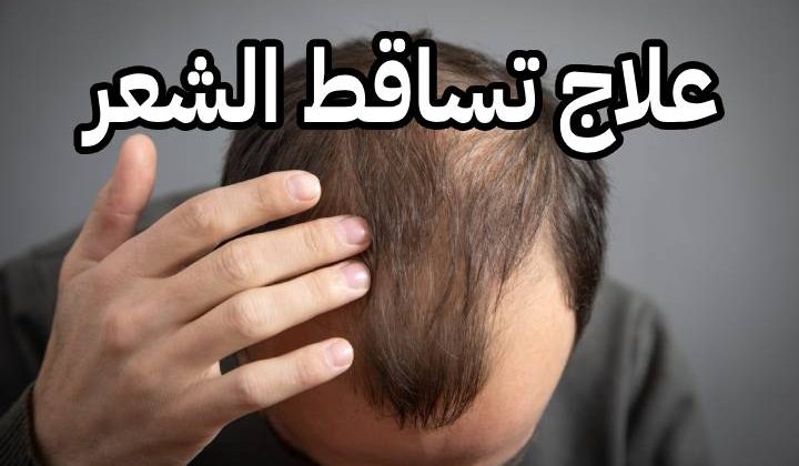الطب البدل النبوي علاج تساقط الشعر