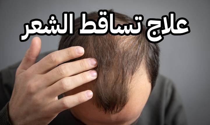 الطب البدل النبوي علاج تساقط الشعر